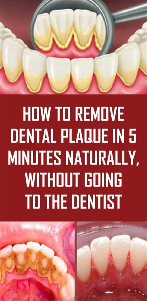 How to Remove Plaque from Your Dog’s Teeth Naturally